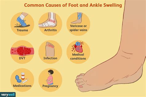 legs leaking fluid|Leg swelling Causes